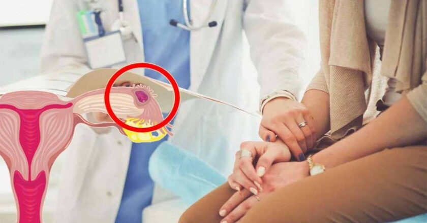 Dış gebelik ihmal edilirse ölüme yol açabilir – Son Dakika Sağlık Haberleri